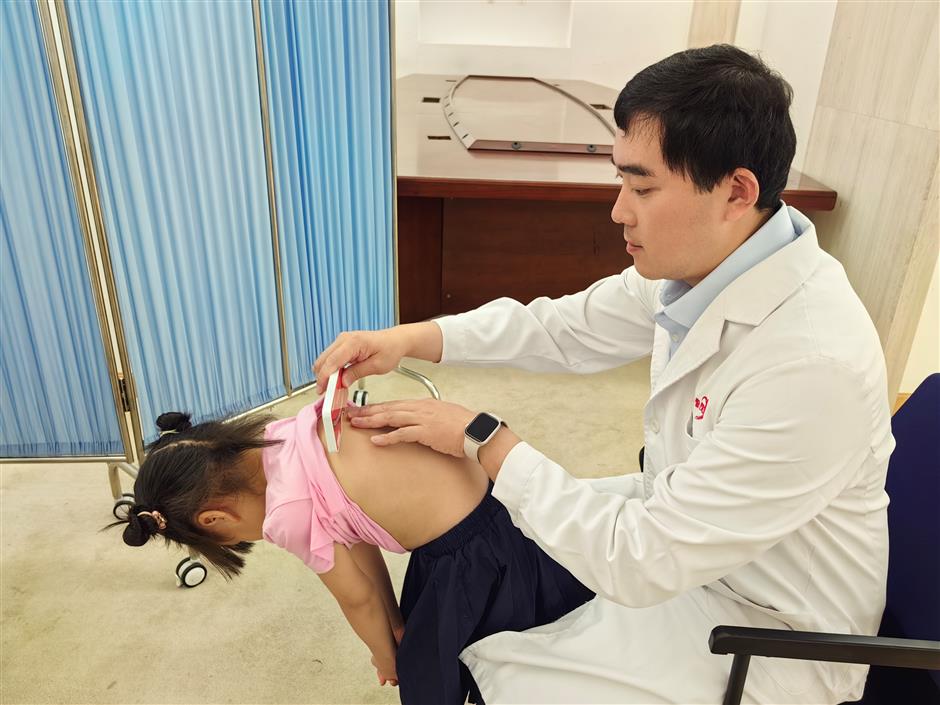 hospital uses ancient tcm method in treatment of curved spine in children