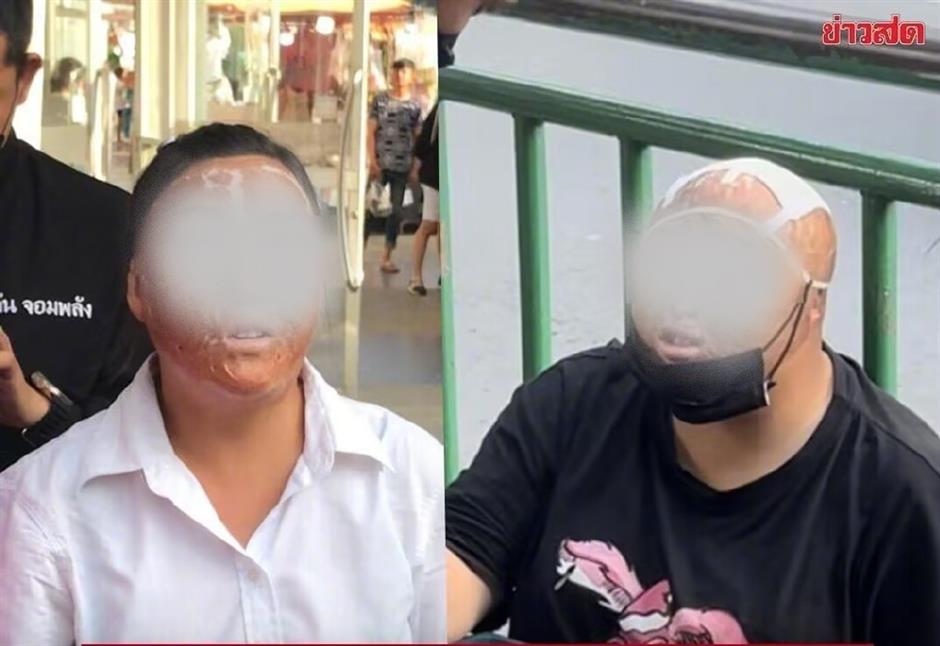 disfigured chinese beggars draw public and police attention in bangkok